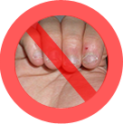 Stop Onychophagie